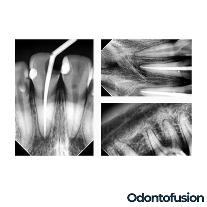 Odontofusion D2 Intraoral Sensor